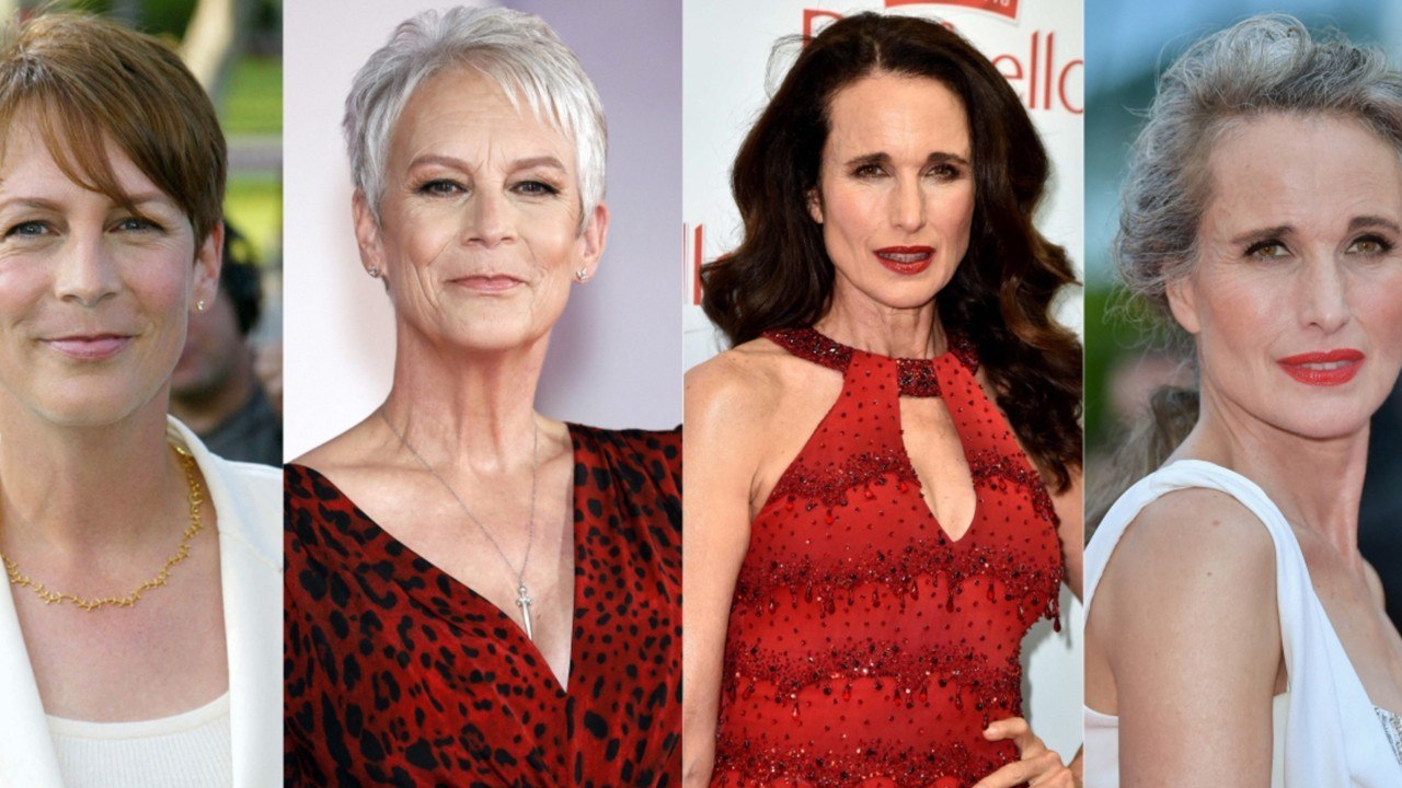 10 avants/après de stars qui ont opté pour les...
