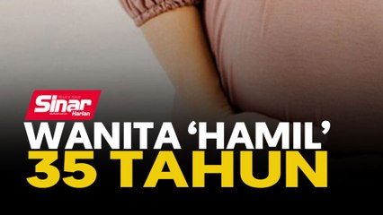 Wanita 'hamil' 35 tahun