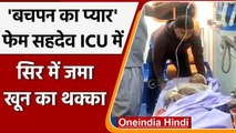 Sahdev Dirdo Health: Bachpan ka pyar वाला सहदेव की हालत में सुधार नहीं, जानें अपडेट | वनइंडिया हिंदी