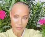 Jada Pinkett Smith Opened Up About Accepting Her Alopecia