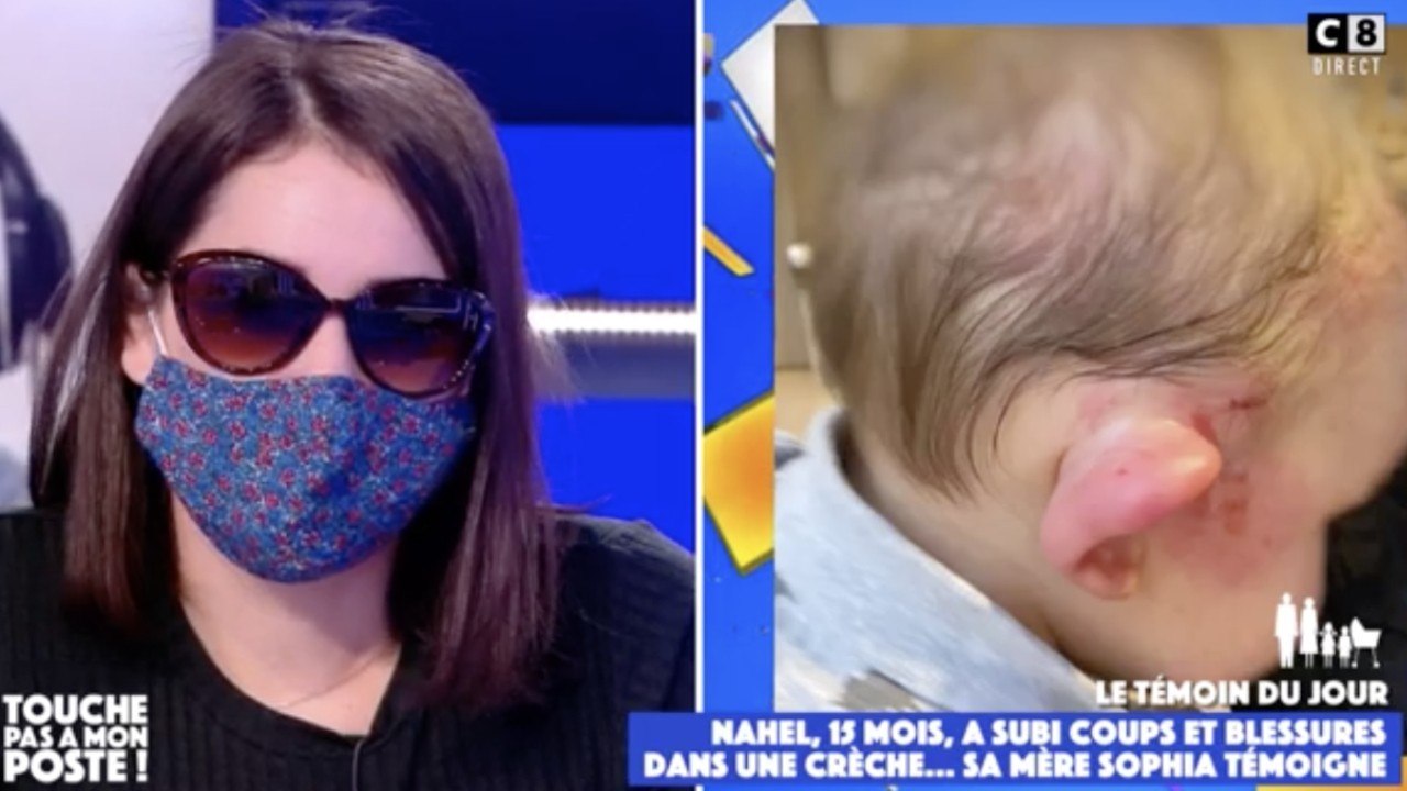 FEMME ACTUELLE - TPMP : le témoignage alarmant d'une mère qui retrouve son fils de 15 mois le visage tuméfié à la crèche