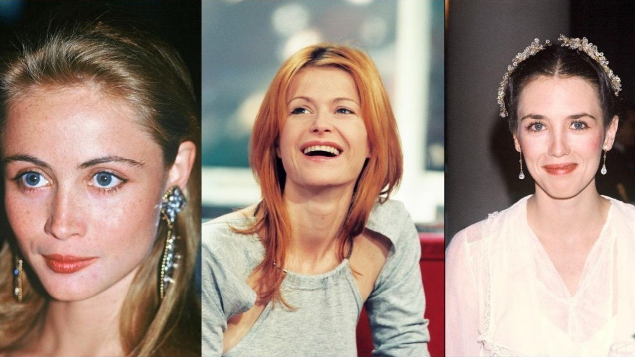 FEMME ACTUELLE - Avant/après, ces stars qui ont refait leurs lèvres