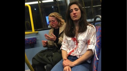 FEMME ACTUELLE - Homophobie À Londres : Elles Sont Agressées Violemment Parce Qu'elles Refusent De S'embrasser