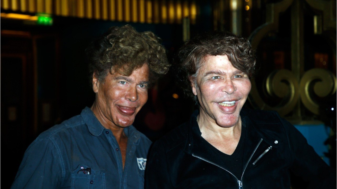 FEMME ACTUELLE - Igor et Grichka Bogdanoff : une journaliste fait de nouvelles révélations sur leur transformation physique