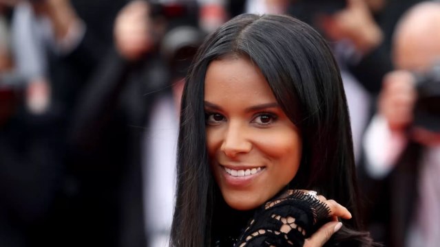 FEMME ACTUELLE - Shy'm a-t-elle eu recours à la chirurgie esthétique ?