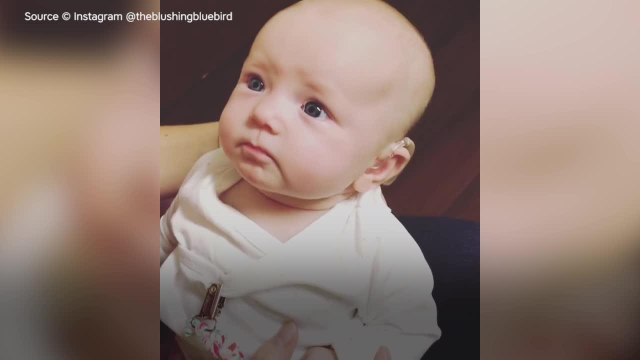 FEMME ACTUELLE - L’émouvante réaction d’un bébé sourd qui entend la voix de sa mère pour la première