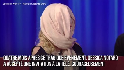 FEMME ACTUELLE - L'ancienne Miss brûlée à l'acide par son ex dévoile son visage