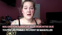 FEMME ACTUELLE - Kaitlyn, privée de ses 4 membres, devient une blogueuse beauté