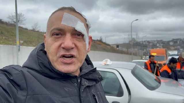 ARNAVUTKÖY'DE OTOMOBİLLER KAFA KAFAYA ÇARPIŞTI, SÜRÜCÜLER YARALANDI