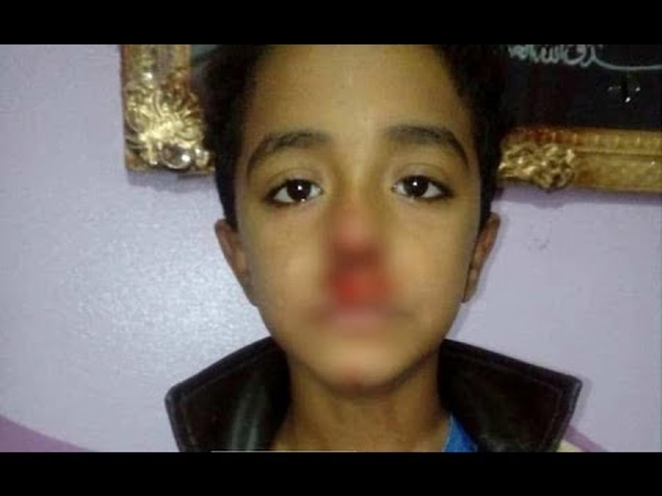 صدم رأسه بالحائط وتنمر به..  حكاية مدرس اعتدى على تلميذ في زفتى