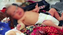 Malnutriti e venduti dalle famiglie: il triste destino dei bambini afghani