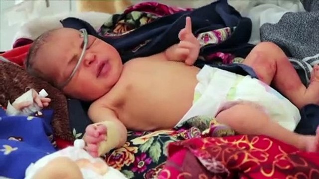 De plus en plus d'enfants afghans sont menacés par la maladie et la malnutrition