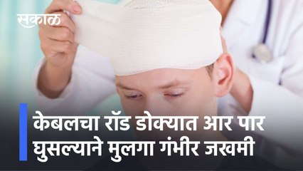 Pune: केबलचा रॉड डोक्यात आर पार घुसल्याने मुलगा गंभीर जखमी