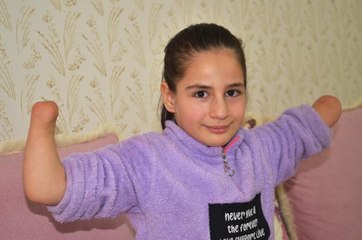 KÜÇÜK RABİA PROTEZ EL İSTİYOR