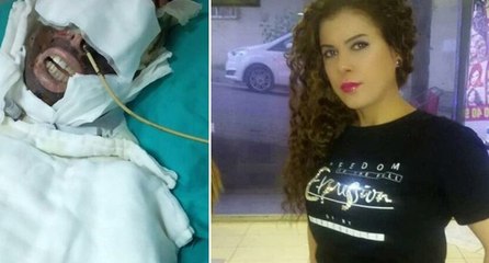 Yüzü kemiklerine kadar yanmıştı! O sapığa istenen ceza belli oldu