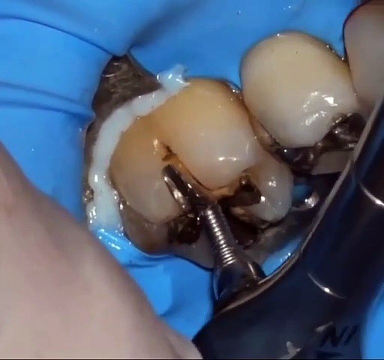 VID_20220103224141