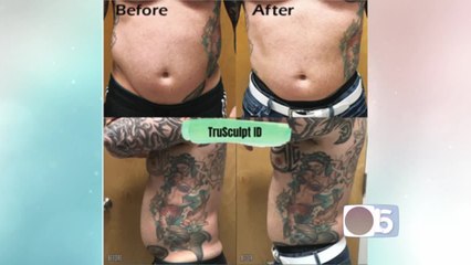 VJuv says they can help you melt the fat away