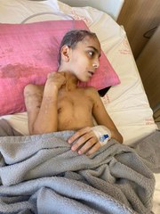 Sokak köpeklerinin saldırdığı Enes, 9 ameliyatla yaşama tutundu