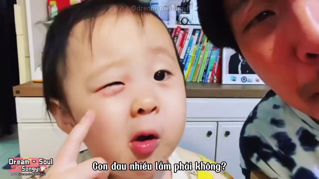 SONGYI BỊ ĐAU MẮT