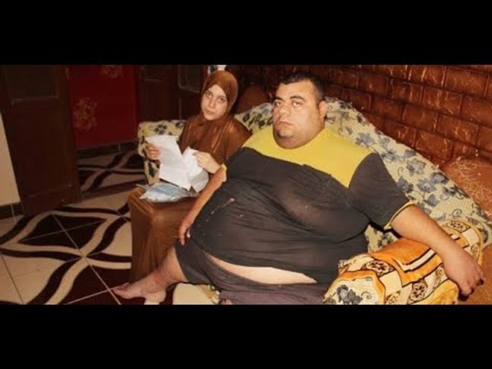 مريض السمنة عقب الجراحة الناجحة :  بقيت أمشي وحاسس إني خفيف