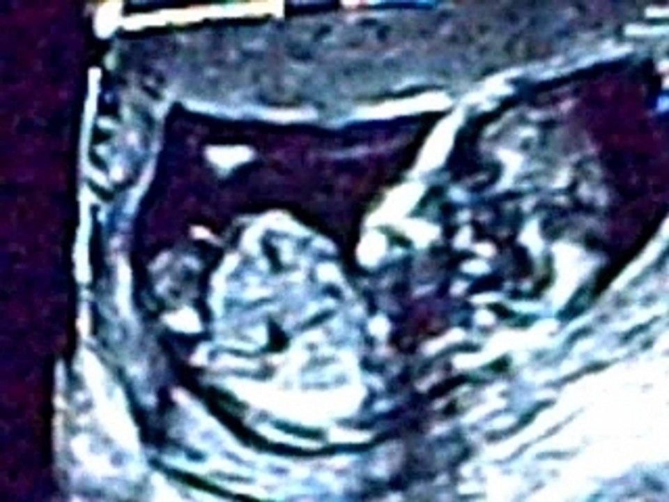 Bébé