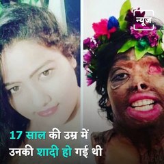 Meet Zakira Shaikh, An Acid Attack Survivor Who Is A Make-Up Artist Today