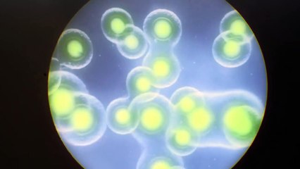 Cleverman Saison 2 - Trailer (EN)