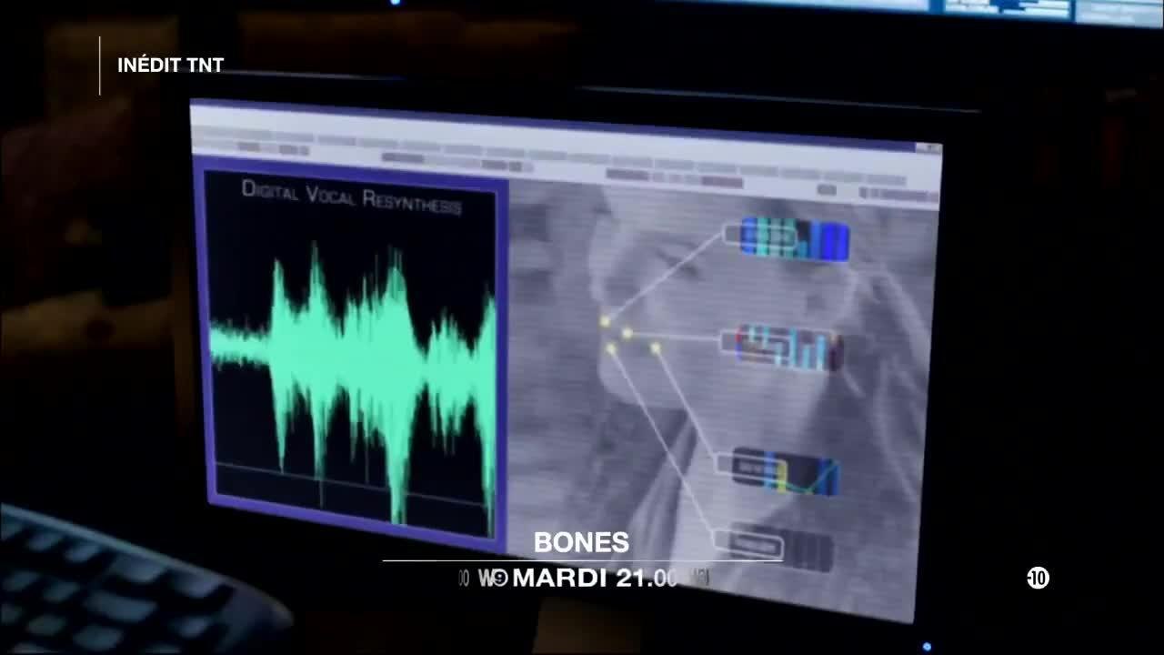 Bones