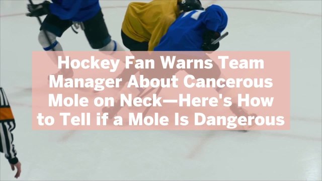Hockey Fan Warns Team Manager About Cancerous Mole on Neck—Here's How to Tell if a Mole Is