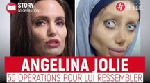 Une fan d'Angelina Jolie s'affame et fait plus de 50 opérations pour ressembler à la star