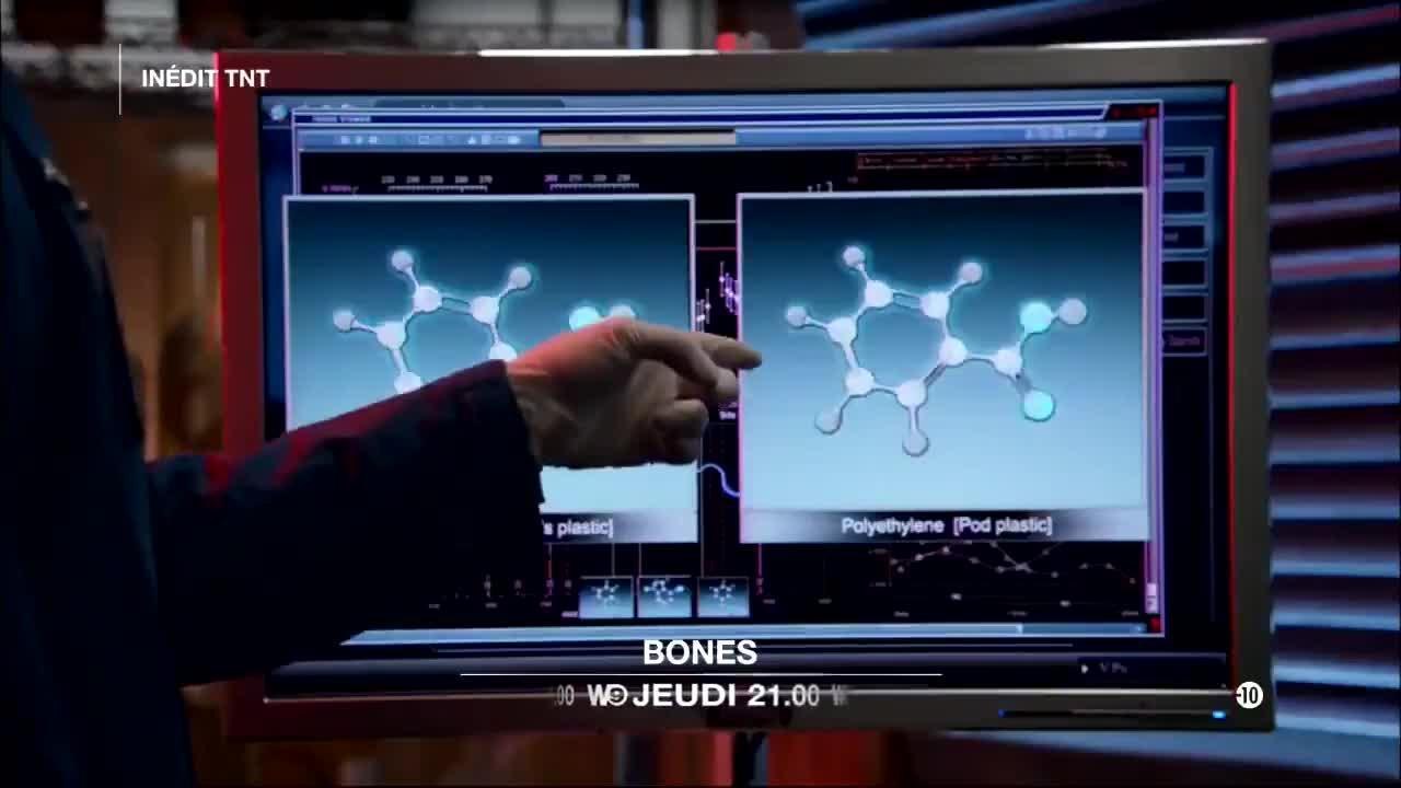 Bones