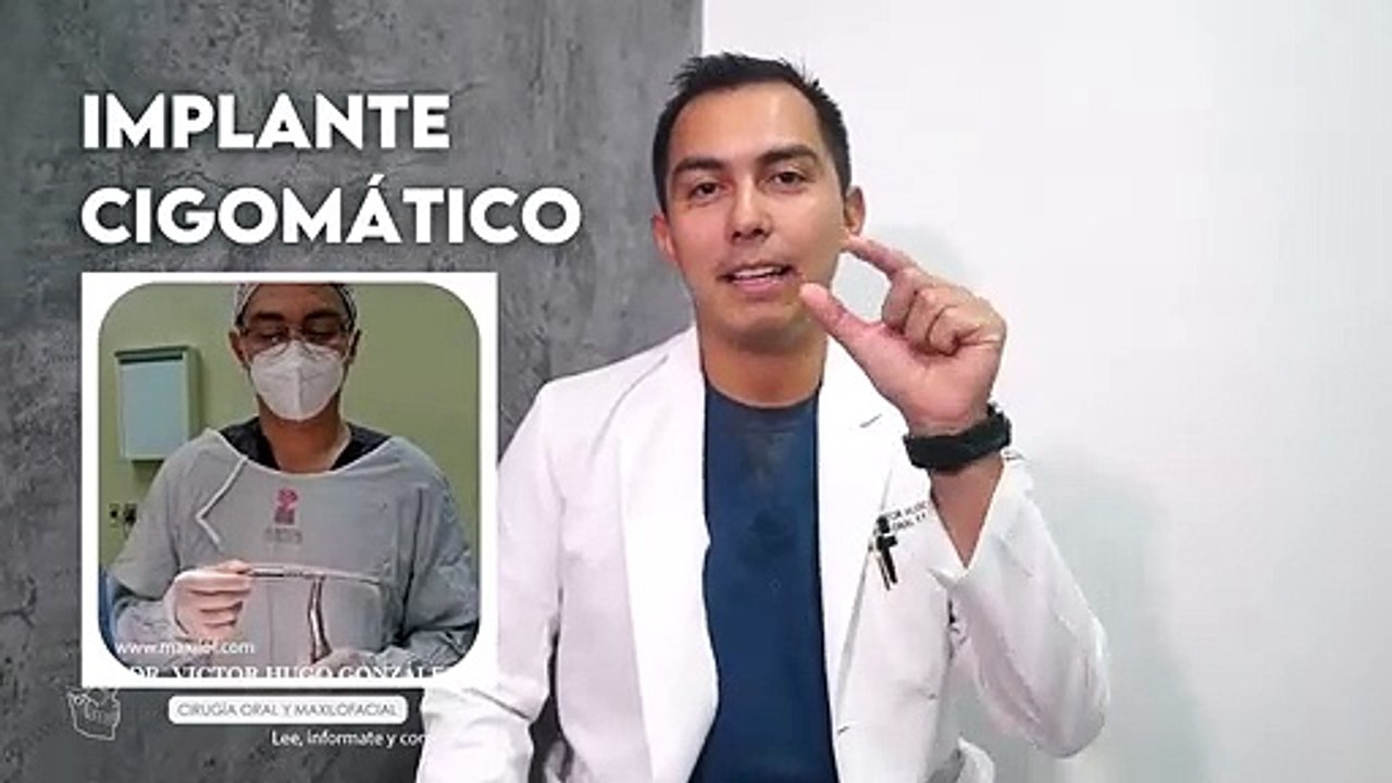 ImplantesCigomaticosIntroduccion