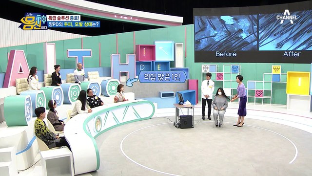 심각한 상태였던 모발 상태, 놀라운 '아마씨 샴푸&헤어 팩'의 효능