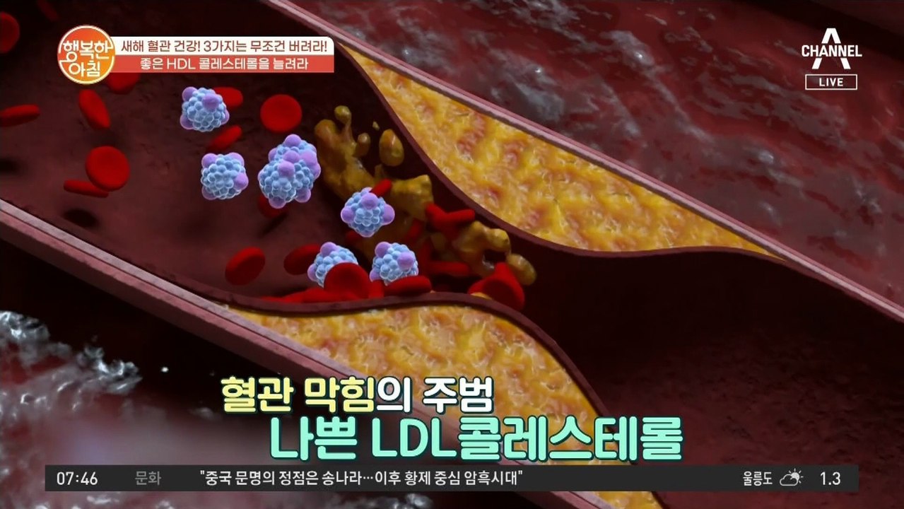 좋은 콜레스테롤 'HDL'을 늘려야 산다! 혈관 건강 완전 정복♥