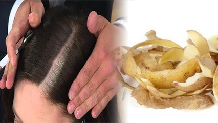 आलू के छिलकों से बाल काले करने का ये नुस्खा जान दंग रह जाएंगे आप | Boldsky