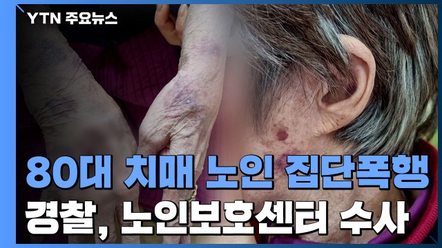 노인보호센터서 80대 치매 할머니 집단폭행 ...경찰 수사 / YTN