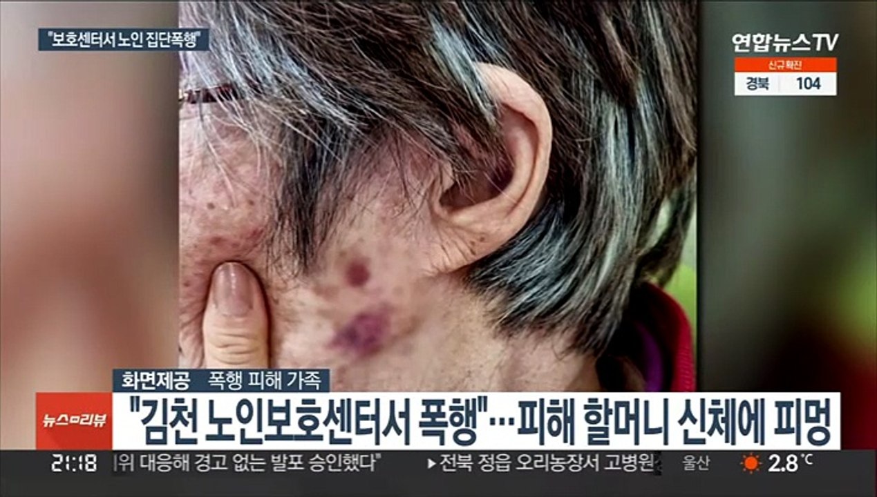 "보호센터서 80대 치매 노인 집단폭행"…갈비뼈 골절 중상