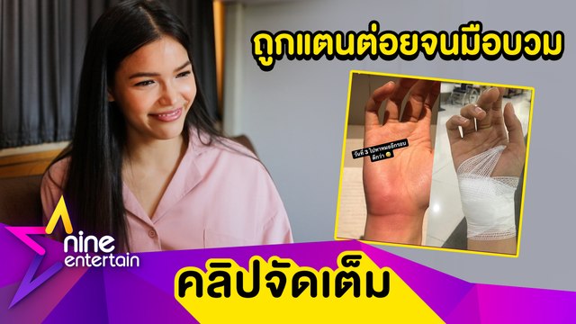 “ฟ้าใส” เล่านาทีสุดช็อกโดนแตนต่อยจนมืออักเสบ โชคดีไม่แพ้หนัก (คลิปจัดเต็ม)