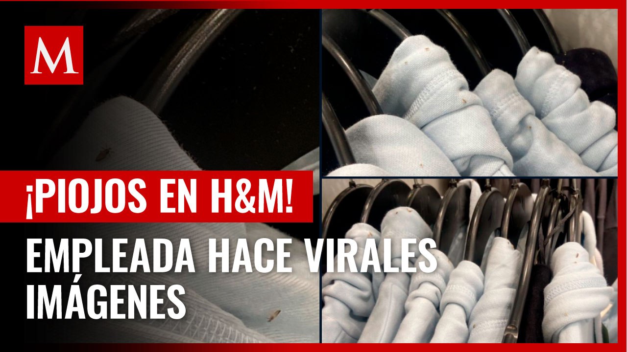 ¡Cuidado con lo que te pones! Empleada de H&M encuentra piojos en la ropa; fotos se vuelven virales