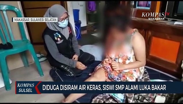 Diduga Disiram Air Keras, Siswi SMP Alami Luka Bakar