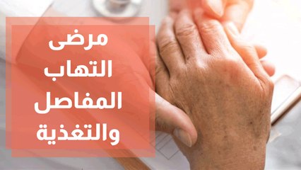 أغذية يجب تفاديها لمرضى التهاب المفاصل