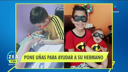 ¡Niño pone uñas para ayudar a pagar las operaciones de su hermano!
