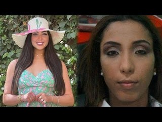 دنيا بطمة ليست الأولى.. عمليات تجميل غيرت ملامح الفنانات  180 درجة