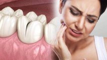 दांत में झनझनाहट हो तो क्या करना चाहिए, Root Canal से लेकर Gum Seal करना | Boldsky