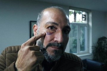 VETERİNER HEKİM DARP ŞÜPHELİSİ İLK O VURDU, EŞİME KÜFRETTİ