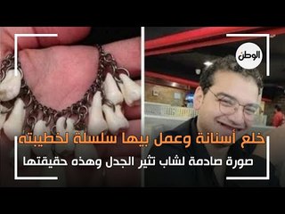خلع أسنانه وصنع منها عقدا لحبيبته.. صورة صادمة لشاب تثير الجدل وهذه حقيقتها