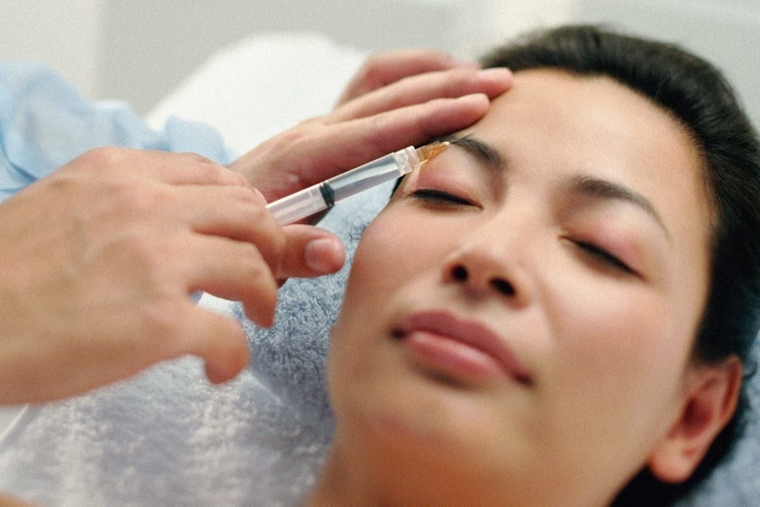 6 Post-Botox Mistakes Way Too Many People Are Making