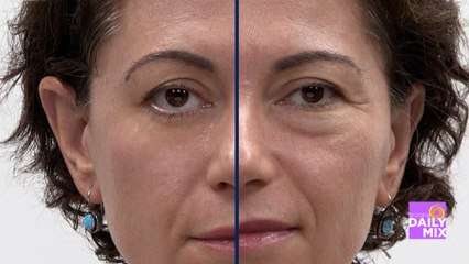 Look Younger in 10 Minutes with the Plexaderm Trial Pack!