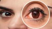 आंखों में सूजन दूर करने का जबरदस्त तरीका | Boldsky