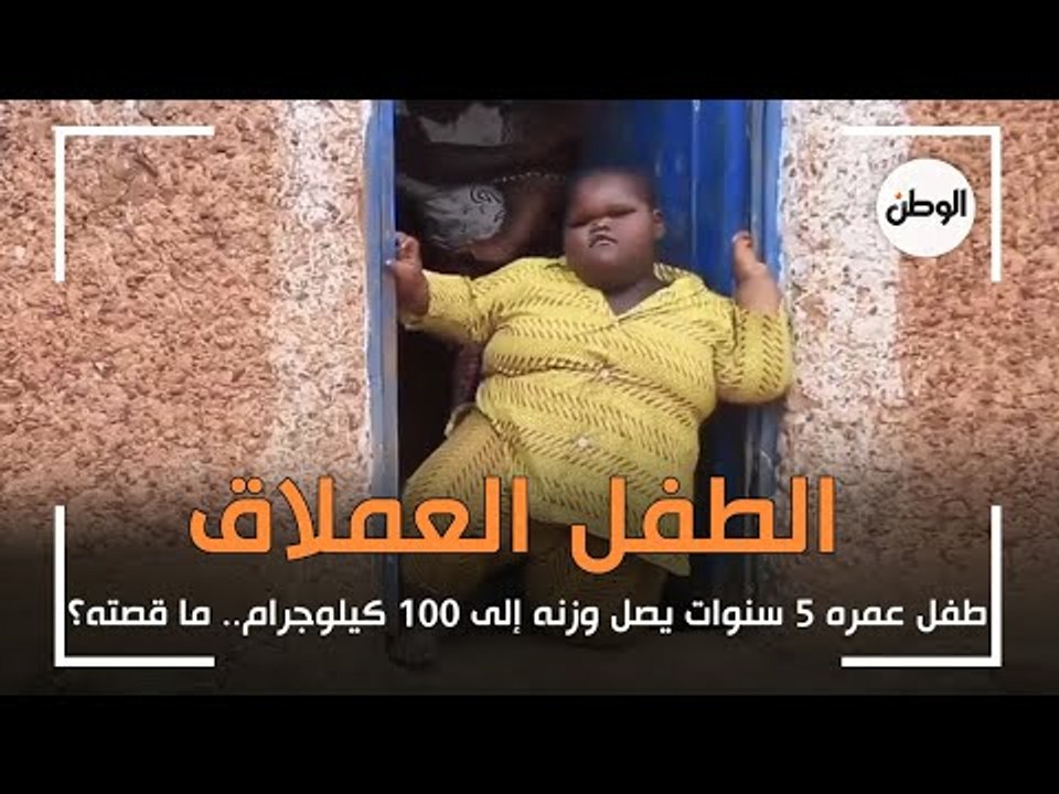 الطفل العملاق: عمره 5 سنوات ووزنه 100 كيلوجرام....